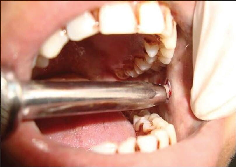 Oral Biopsy Facility